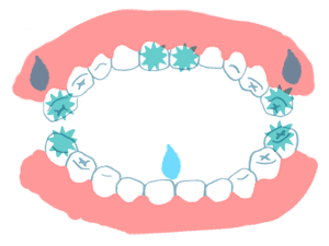 仕上げみがきのポイント