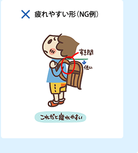 疲れやすい形(NG例)