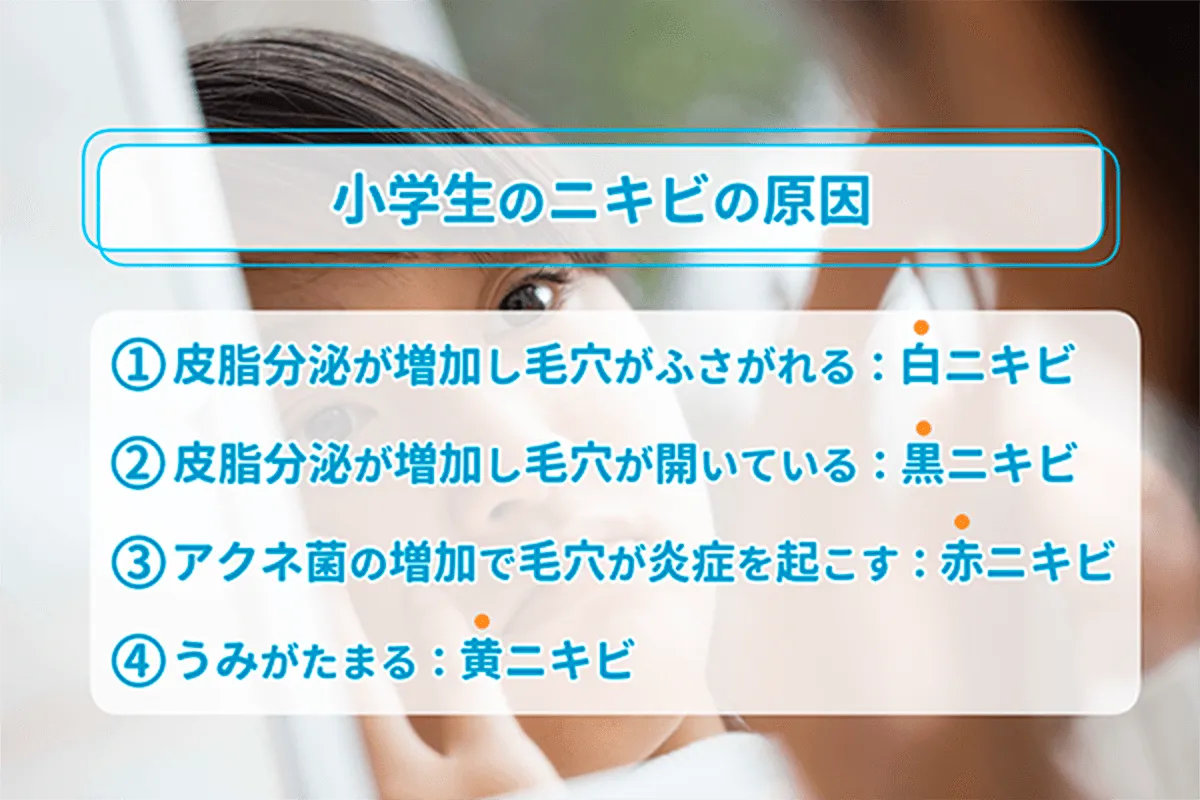 小学生のニキビの原因